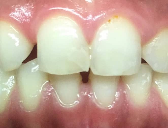 Before - Smile 360