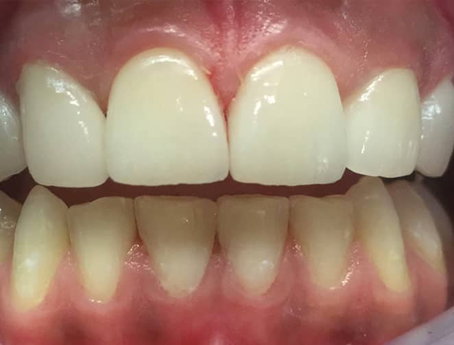 After - Smile 360