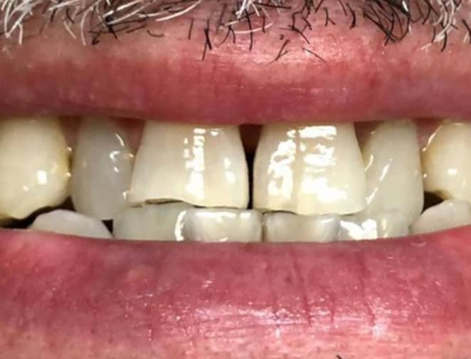 Before - Smile 360