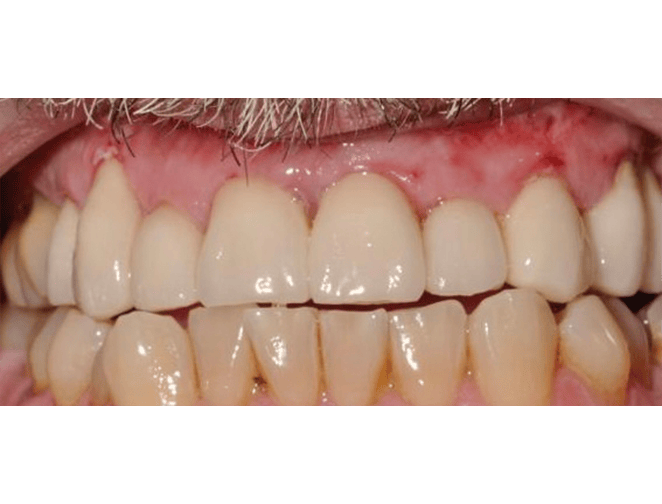 After - Smile 360