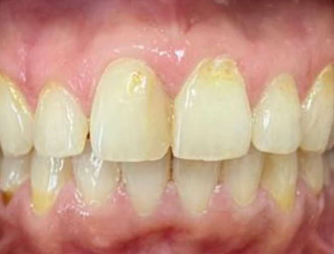 Before - Smile 360