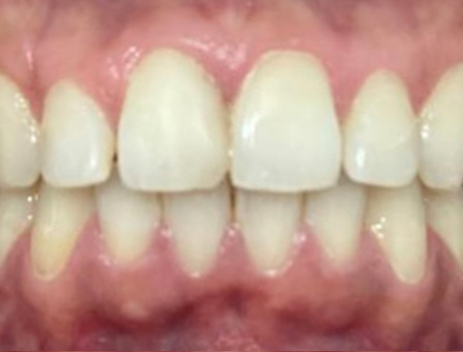 After - Smile 360