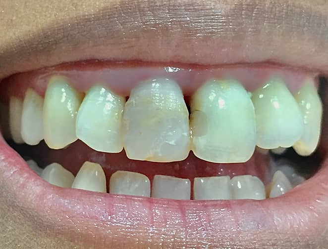 Before - Smile 360
