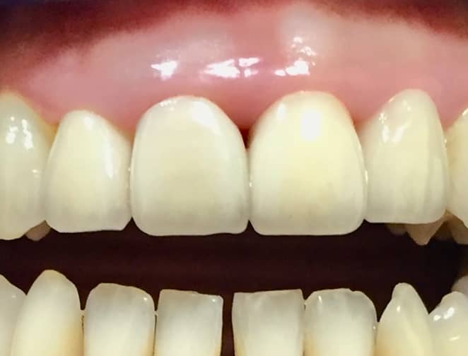 After - Smile 360