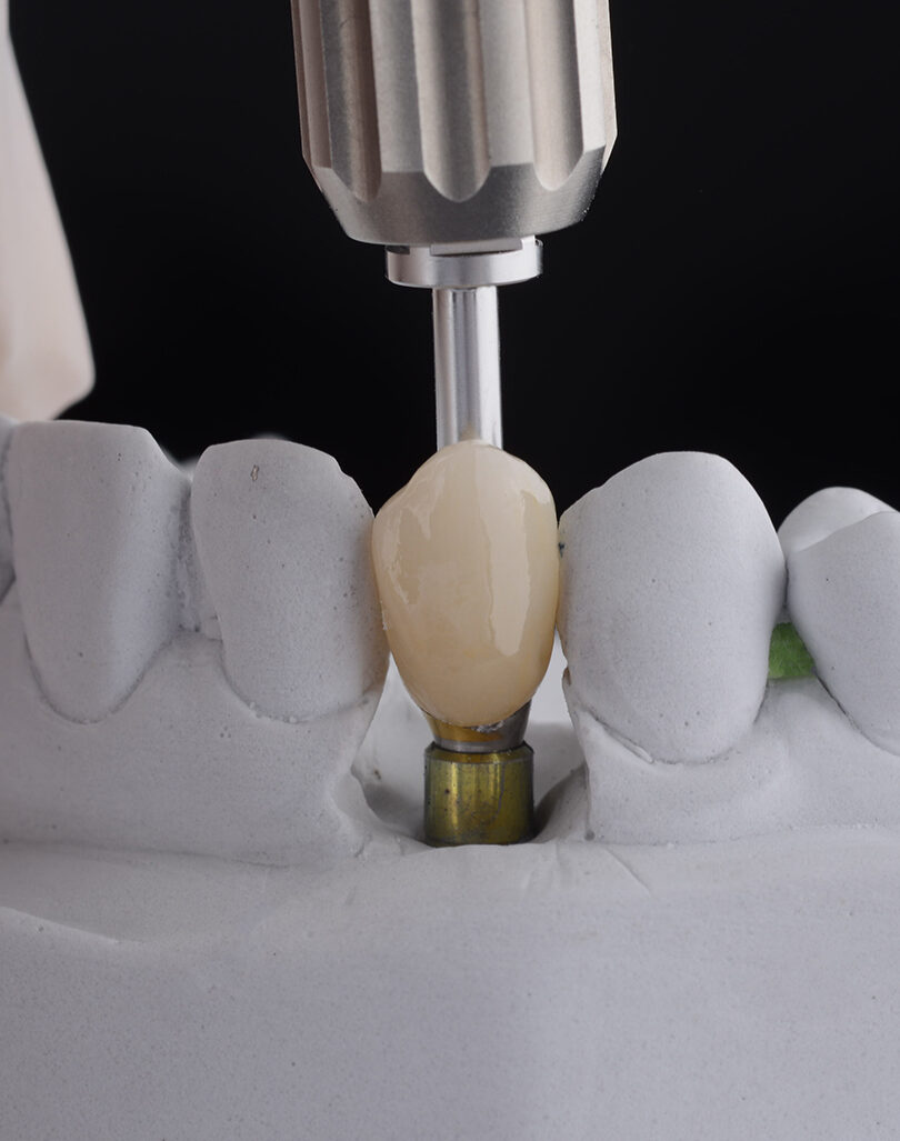 Treatment - Smile 360